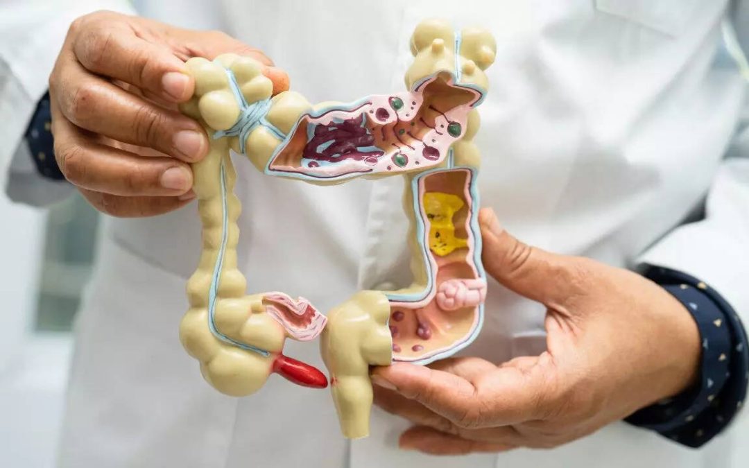 Appendix cancer is no longer rare for millennials and Gen X: Study
