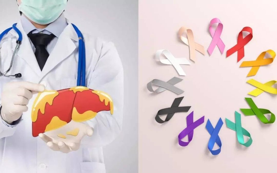 Can fatty liver increase cancer risk? Know the signs and how to prevent it